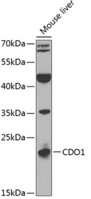 Western Blot: Cysteine Dioxygenase Type 1 Antibody [NBP2-92543] - Western blot analysis of extracts of mouse liver, using Cysteine Dioxygenase Type 1 antibody (NBP2-92543) at 1:1000 dilution. Secondary antibody: HRP Goat Anti-Rabbit IgG (H+L) at 1:10000 dilution. Lysates/proteins: 25ug per lane. Blocking buffer: 3% nonfat dry milk in TBST. Detection: ECL Basic Kit. Exposure time: 30s.